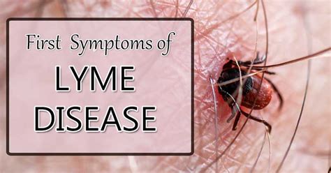 First Symptoms Of Lyme Disease Real Stories Of What Lyme Feels Like