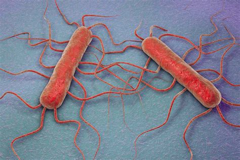 Listeria Signs Symptoms And Complications
