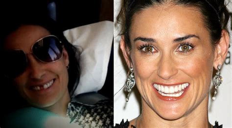 Demi Moore Reveals Shes Missing Her Two Front Teeth So How Did It Happen