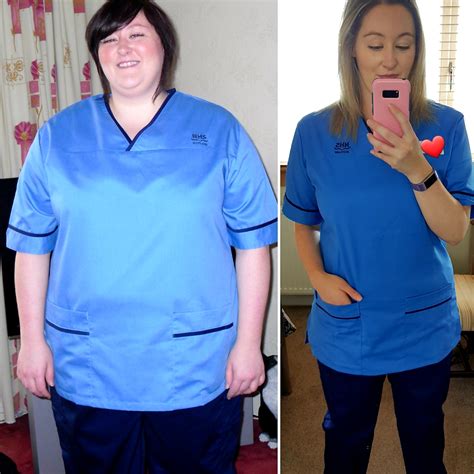 25 Before And After Weight Loss Transformations Inspiremore
