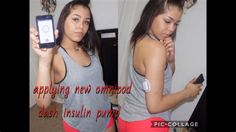 We did not find results for: Omnipod Dash Insulin Pump Apply | typeone_brie - YouTube
