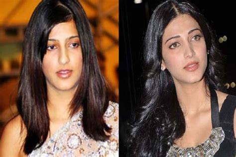 How Plastic Surgery Transformed B Actresses Into Divas