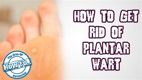 How To Get Rid Of Plantar Wart And Remove It Fast Youtube