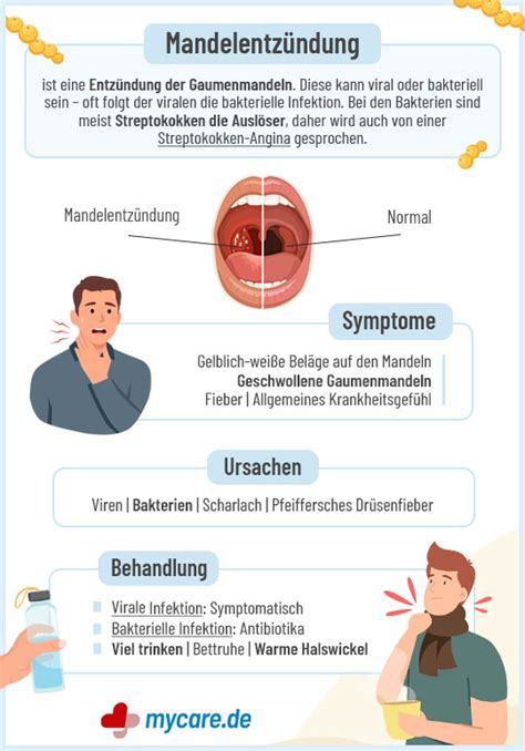 Ratgeber Mandelentzündung Symptome Und Ursachen Einer Tonsillitis