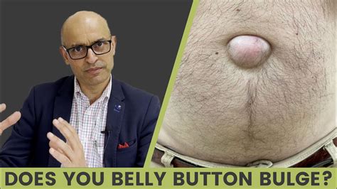 does your belly button bulge youtube