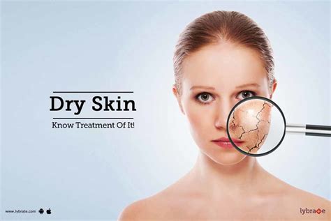 Dry Skin Know Treatment Of It By Dr Rashmi S Lybrate