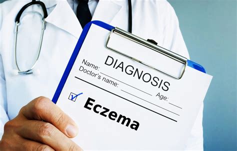 Eczema All You Need To Know About Eczema Page 6 Of 8 Healthella