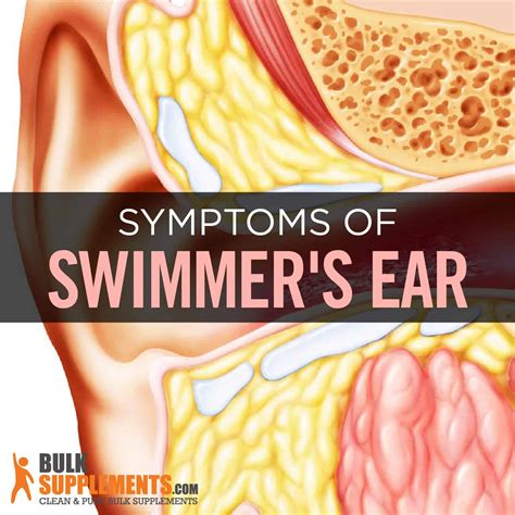 What is Swimmer's Ear: Causes, Symptoms & Treatment