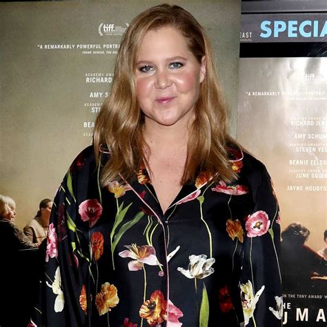 Amy Schumer Addresses Her Decision To Reveal Liposuction Surgery Us