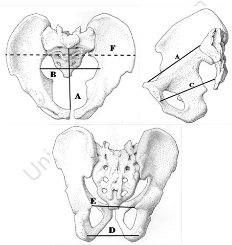 Figure 21 From The Bony Pelvis Scars Of Parturition And Factors