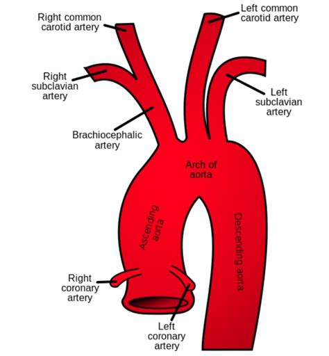 Subclavian Artery Steal Syndrome