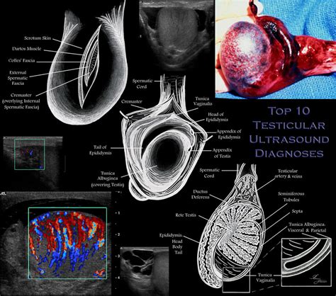 Scrotal Anatomy Ultrasound