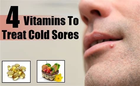 Top 4 Vitamins To Treat Cold Sores Natural Home Remedies And Supplements