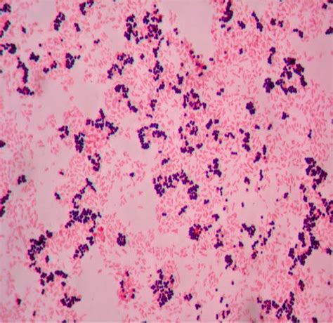 Gram Stain Red Mountain Microbiology