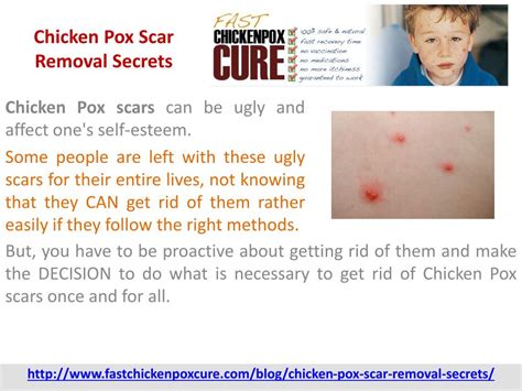Ppt Chicken Pox Scar Removal Secrets Powerpoint Presentation Free