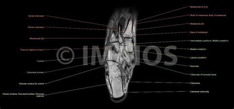 There are 10 intrinsic muscles located in the sole of the foot. Anatomy of the foot and ankle - MRI