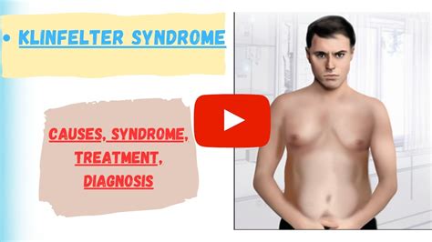 Understanding Klinefelter Syndrome It S Causes Symptoms Diagnosis