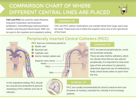 Cvc Vs Picc Lines Free Cheat Sheet Lecturio Nursing