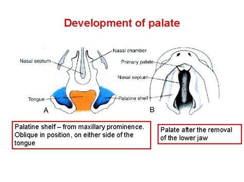 Development Of Palate Can Be Divided Into Two