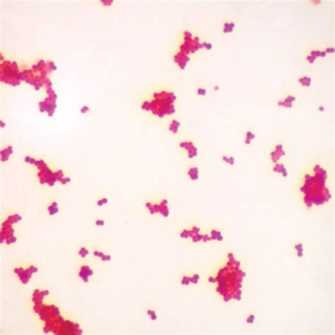 Buy Gram Negative Coccus W M Gram Stain Microscope Slide Online At Low Prices In India