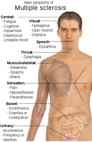 Multiple Sclerosis Symptoms Diagnoses Treatment Pictures What Is Multiple Sclerosis
