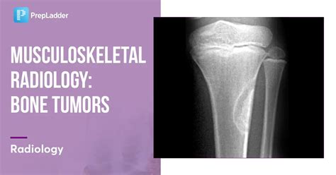 Musculoskeletal Radiology Bone Tumors