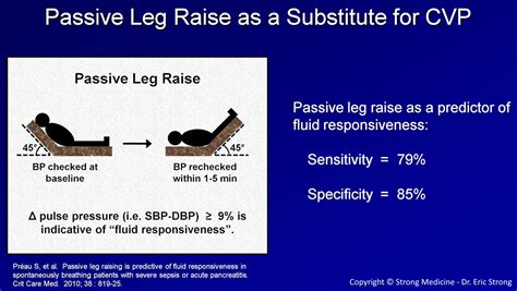 Passive Leg Raise As A Substitute For Cvp Pulse Pressure Grepmed