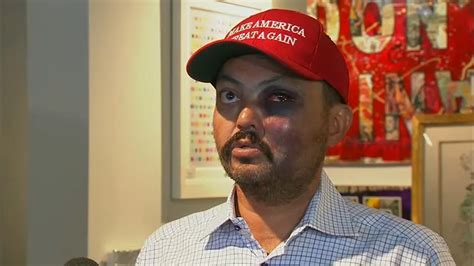New York City art gallery owner says he was attacked for wearing MAGA hat - ABC13 Houston