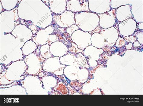 Human Lung Tissue Image And Photo Free Trial Bigstock