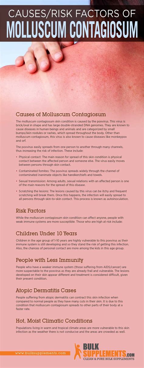 Molluscum Contagiosum Symptoms Causes And Treatment
