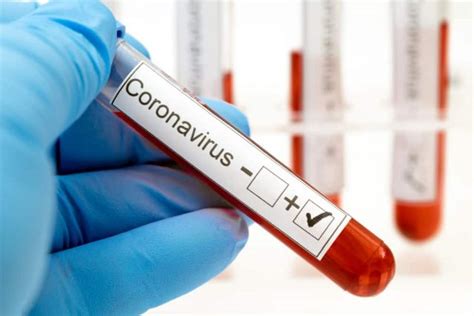 Coronavirus Definisi Penyebaran Hingga Pencegahan Hello Sehat