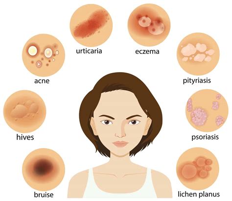 Diagram showing different skin conditions – Swiss Point of Care