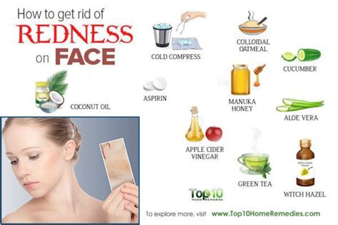 How To Get Rid Of Redness On Face Top 10 Home Remedies