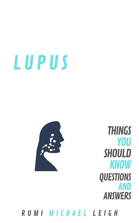 Lupus Things You Should Know Questions And Answers Etsy