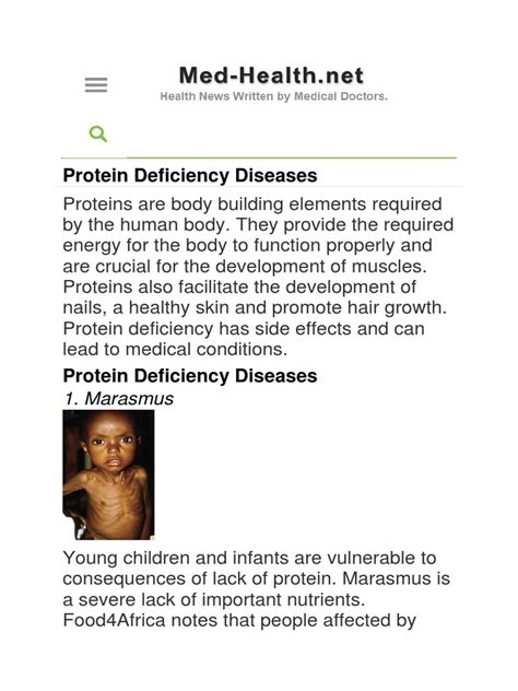 Protein Deficiency Diseases Causes Symptoms And Treatments Of