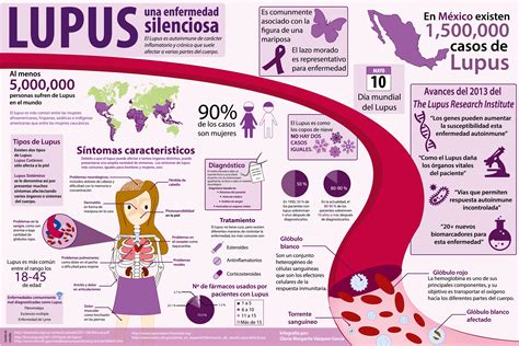 Lupus Una Enfermedad Silenciosa Ciclo Imagen Para El Diagnóstico Y