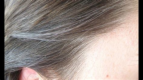 Other causes of premature graying of hair are an unclean condition of the scalp, drying it with an electric dryer, and use of hair dyes. Premature Graying of Hair - Home Remedy - YouTube