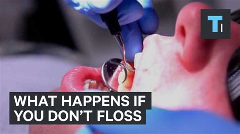 what happens if you don t floss youtube