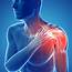 Shoulder Pain In Joint  Back Of Treatment
