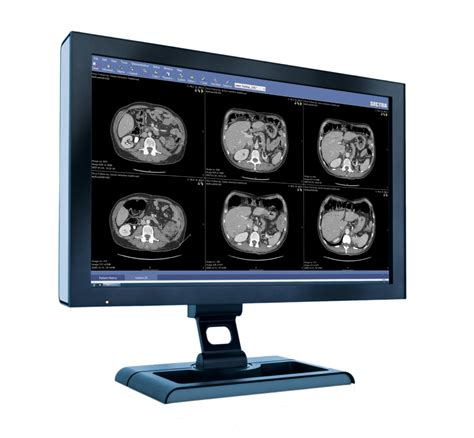 Sectra Lesion Tracking Integrated In Sectra Pacs Sectra Medical