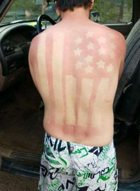 20 People Who Got Accidental Sunburn Tattoos Oh No Sunburn Art