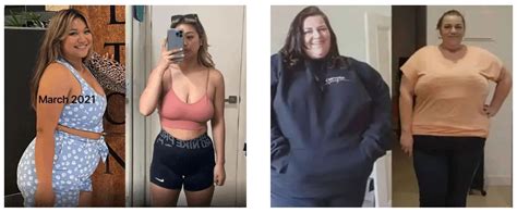 Before And After Ozempic Weight Loss Photos You Need To See To Believe