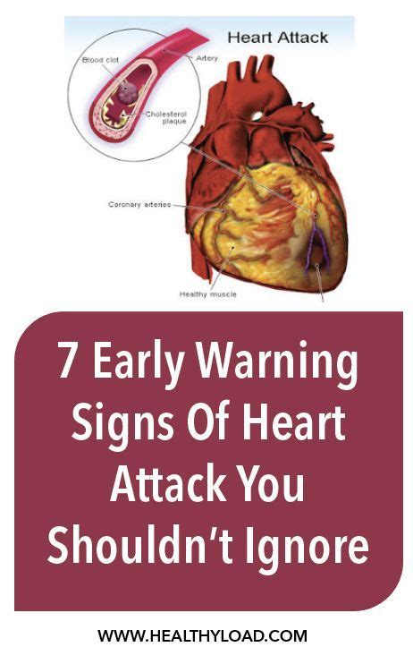 7 Early Warning Signs Of Heart Attack You Shouldnt Ignore