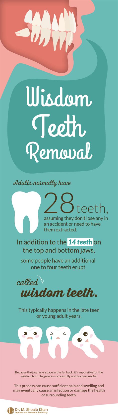 Facts About Wisdom Teeth Removal Dr M Shoaib Khan