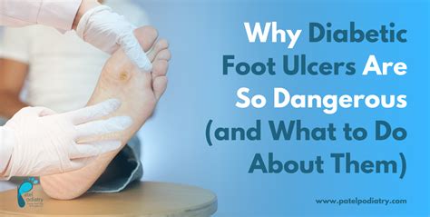 Why Diabetic Foot Ulcers Are So Dangerous And What To Do About Them