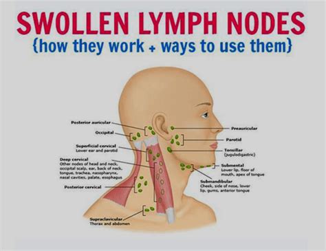Pin On Lymphatic