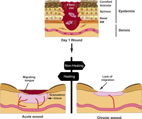 Frontiers Chronic Wound Healing By Amniotic Membrane Tgf And Egf Signaling Modulation In Re