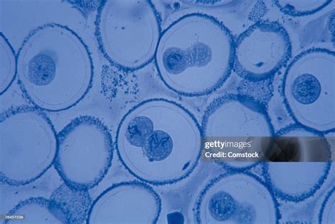Ascaris Bivalent Mitosis Magnified 200x High Res Stock Photo Getty Images