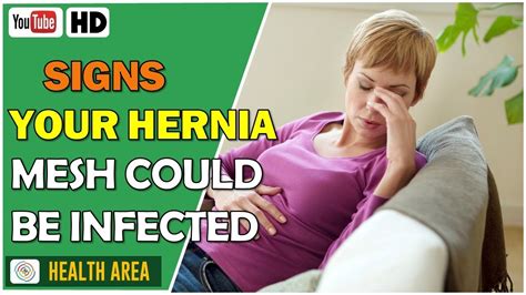 6 Signs Your Hernia Mesh Could Be Infected Youtube