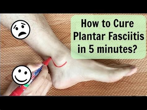 It causes irritation, inflammation, and, eventually, pain. How To Cure Plantar Fasciitis(Heel Pain) in 5 minutes ...